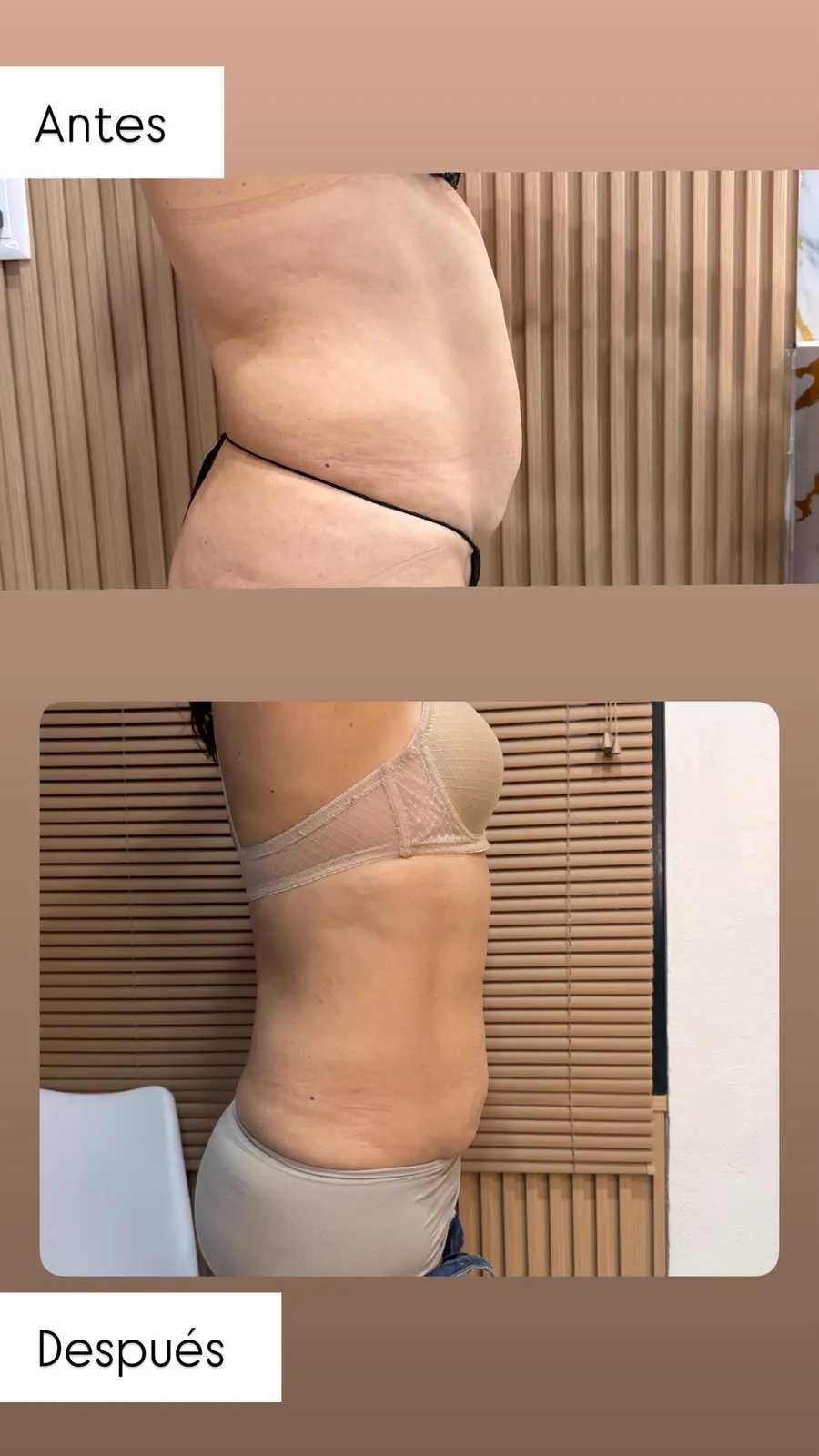 Abdomen, vista lateral