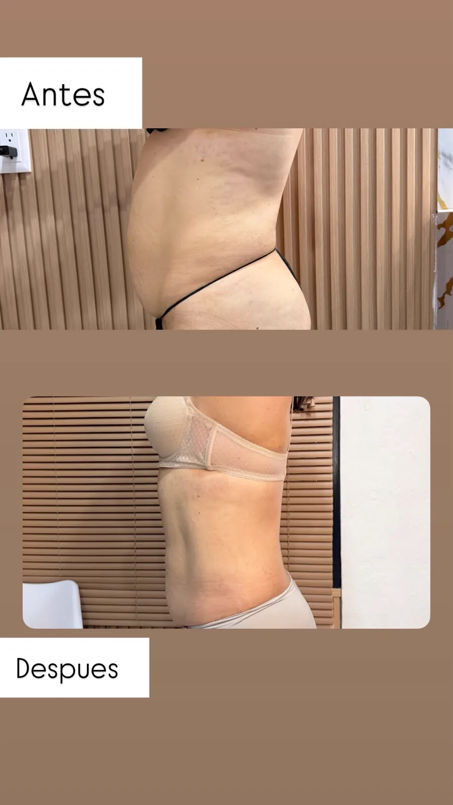 Abdomen y cintura, perfil